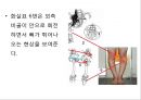 0 & X 다리의 이해 및 운동運動 방법 26페이지
