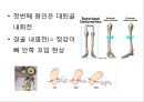 0 & X 다리의 이해 및 운동運動 방법 27페이지