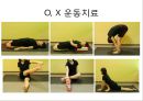 0 & X 다리의 이해 및 운동運動 방법 31페이지