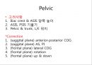 측만증側彎症 이해 및 운동 방법 소개 68페이지