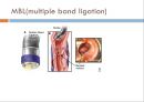UGI bleeding.pptx 30페이지