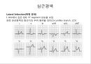 심근경색 & 허혈성질환.pptx 6페이지