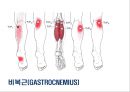 05. 다리 근육 (Leg muscle) - 2 의 기시, 정지 , 작용 , TP사진, 기능적 단위 등.pptx 26페이지