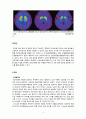 파킨슨병 About The Parkinson`s Disease 8페이지