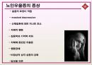 노인기 우울증 원인 및 해결책.ppt 14페이지