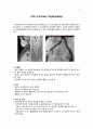 심근경색(MI: myocardial infarction) 11페이지