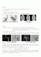 Subarachnoid Hemorrhage(SAH, 지주막하 출혈) 3페이지