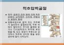 척추 수술 환자 간호(척추압박골절,VP,KP,MBB) 6페이지