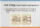 척추 수술 환자 간호(척추압박골절,VP,KP,MBB) 8페이지