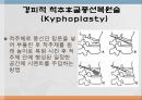 척추 수술 환자 간호(척추압박골절,VP,KP,MBB) 11페이지