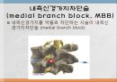 척추 수술 환자 간호(척추압박골절,VP,KP,MBB) 21페이지