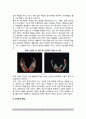 [영아기 뇌의 발달] 영아기의 뇌와 신경계 발달(영아의 두뇌발달) 3페이지