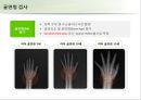 성조숙증 Precocious puberty 11페이지