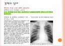 결핵 발표자료ppt 10페이지