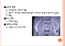 결핵 발표자료ppt 20페이지