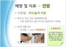 생활습관병 암 [간암, 위암, 폐암, 유방암, 대장암, 간암 예방과 치료] 9페이지
