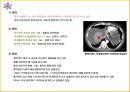 케이스스터디 간암 4페이지