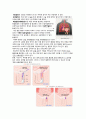 ★ 성인간호학 - 탈장 ( 정의, 종류, 원인, 증상, 치료, 합병증, 간호, 예방방법 )  4페이지