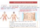 ★ 성인간호학 - 당뇨병 ( 당뇨병의 병태생리,당뇨병의 원인, 당뇨병의 종류, 당뇨병의 진단기준, 당뇨병의 증상, 당뇨병의 합병증, 당뇨병의 치료, 질환고찰, 간호력, 간호사정, 간호과정 ) 36페이지