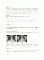  성인간호학 - 폐암 ( 정의, 종류, 원인, 예방, 임상증상, 진단검사, 치료, 간호 ) 7페이지