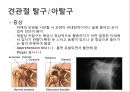 어깨 shoulder 질환의 이해 31페이지