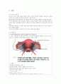 자궁근종(LAVH) 간호과정 3페이지