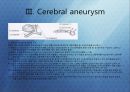 Aneurysm Clipping 17페이지