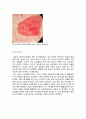 실험보고서 - 구강세포에서 Barr Body 관찰 3페이지