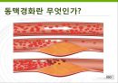 동맥경화증, Arteriosclerosis, 의학용어 4페이지