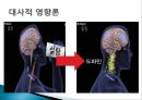 당류의 문제점-ADHD,주의력 결핍과 과잉행동 장애 (ADHD),ADHD의 원인,과잉행동 장애 (ADHD),주의산만, 과잉행동, 충동조절의 어려움 18페이지