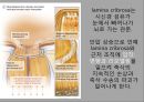 녹내장의 병리와 치료 발표 피피티 9페이지