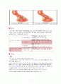 불안정형 협심증 병태생리 및 간호과정 4페이지