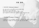 ★ 국제보건론 - 치매 (Dementia)( 선정이유,정의, 증상, 종류, 치료, 예방법, 대책 ) 15페이지