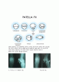 case study(patella Fx) 4페이지