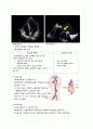 성인간호 케이스, 폐성심, cor pulmonale, ICU 케이스, 중환자실케이스, 가스교환장애, 간호진단, 간호사정, 간호과정 7페이지