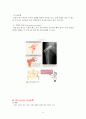 성인간호학 실습 응급실(ER) case study 케이스스터디 늑골골절, 다발성 골절, 폐쇄성 골절, Fracture, 골절, 혈흉) 11페이지