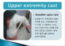 cast, splint 환자간호 (목적,종류,간호) 6페이지