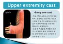 cast, splint 환자간호 (목적,종류,간호) 7페이지