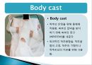 cast, splint 환자간호 (목적,종류,간호) 18페이지