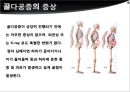 골다공증 PPT 7페이지