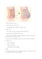 ARF & CRF (급성신부전 & 만성신부전) 23페이지