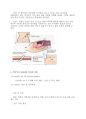 ARF & CRF (급성신부전 & 만성신부전) 26페이지