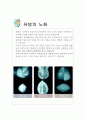 유방질환 2페이지