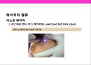 피부미용 치료기기 와 체형관리기& 미용 시술과 성형수술 의 이해 4페이지