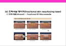 피부미용 치료기기 와 체형관리기& 미용 시술과 성형수술 의 이해 11페이지