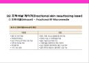 피부미용 치료기기 와 체형관리기& 미용 시술과 성형수술 의 이해 12페이지