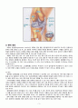 퇴행성 관절염(Degenerative Arthritis) 5페이지
