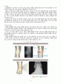 퇴행성 관절염(Degenerative Arthritis) 6페이지