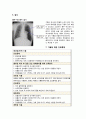 기흉(pneumothorax) Case study 19페이지