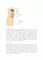 아동투석간호(신대체요법, 혈액투석(HD), 복막투석(PD),지속적 동정맥 혈액 여과(CAVH)) 11페이지